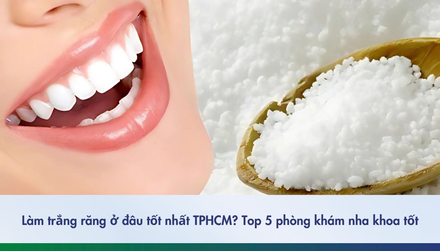 Làm trắng răng ở đâu tốt nhất TPHCM? Top 5 phòng khám nha khoa tốt