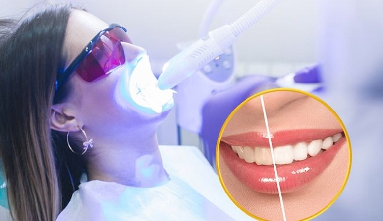 Nha khoa Parkway là một trong những địa chỉ làm trắng răng hàng đầu tại TP.HCM