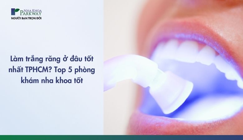 Làm trắng răng là một trong những dịch vụ nha khoa phổ biến tại TP.HCM