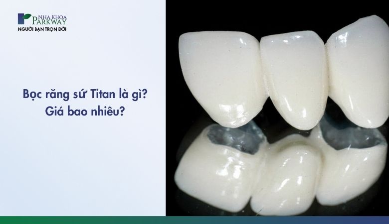 Tại Nha khoa Parkway, dịch vụ bọc răng sứ Titan sử dụng mão sứ có lõi kim loại Titanium