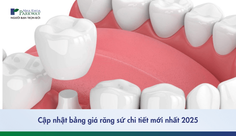 cập nhật bảng giá răng sứ