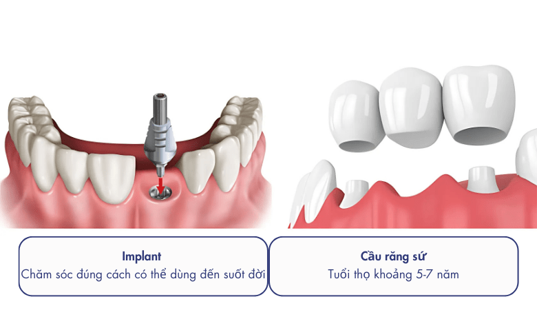 dựa vào độ bền và tuổi thọ
