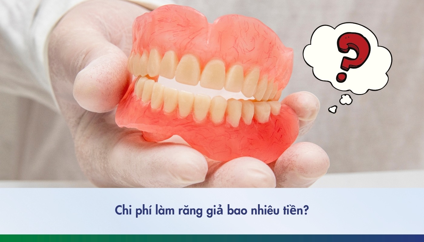 Chi phí làm răng giả mới nhất 2025