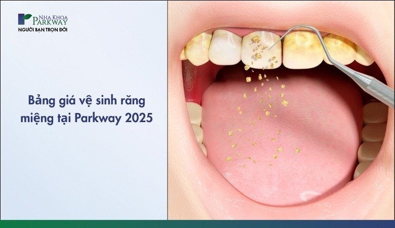 Giá vệ sinh răng miệng tại nha khoa Parkway 2025