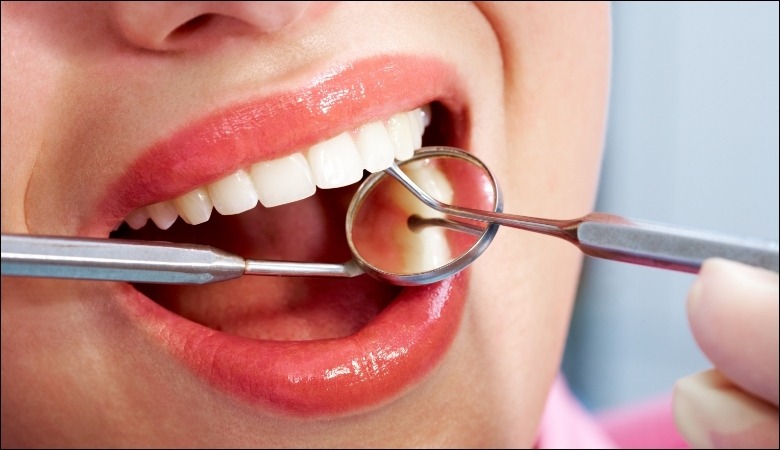 Vệ sinh răng miệng tại nha khoa gồm nhiều dịch vụ khác nhau