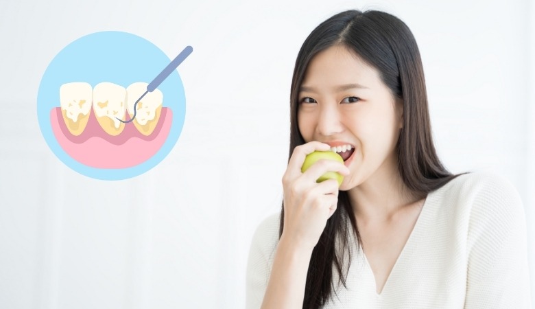 Lợi ích thiết thực khi sử dụng dịch vụ vệ sinh răng miệng tại nha khoa