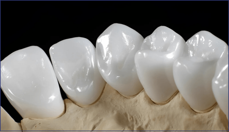 Giá làm răng sứ zirconia