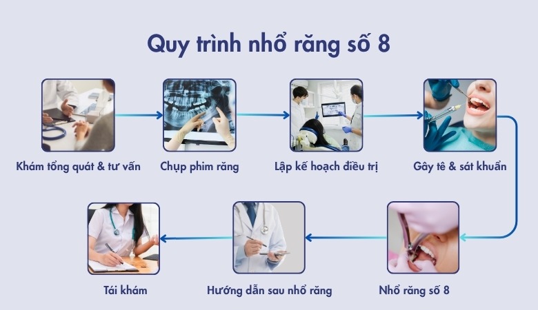 Quy trình nhổ răng số 8 tại nha khoa