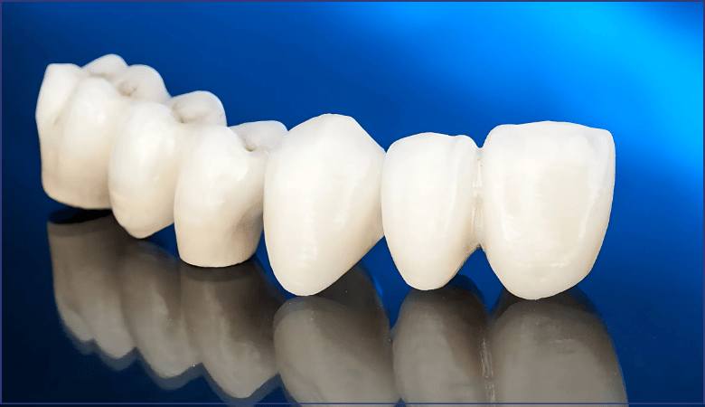  nhược điểm răng sứ zirconia