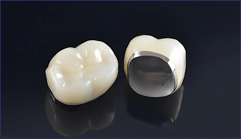 răng sứ kim loại