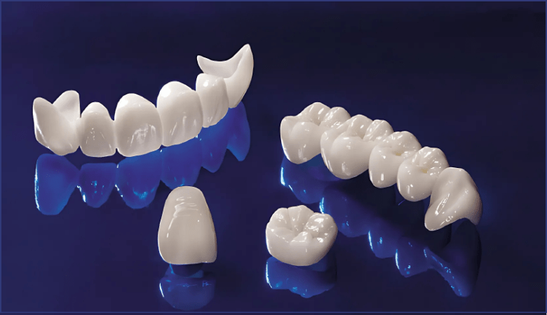 Răng sứ zirconia là gì