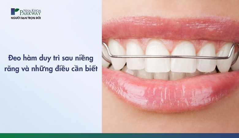 Đeo hàm duy trì và những điều cần biết