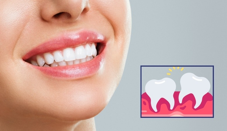 Hàm duy trì tạo một lực nhẹ nhàng để giữ cho răng ổn định tại vị trí mới