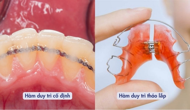 Mỗi loại hàm duy trì sẽ có cách sử dụng khác nhau