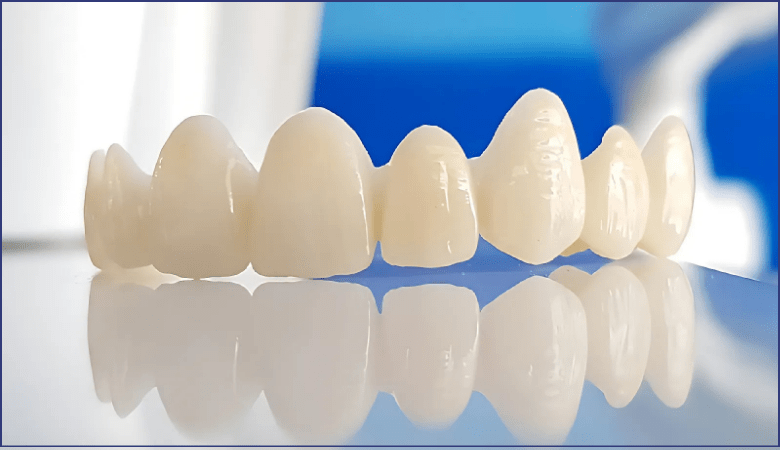 Ưu điểm răng sứ zirconia