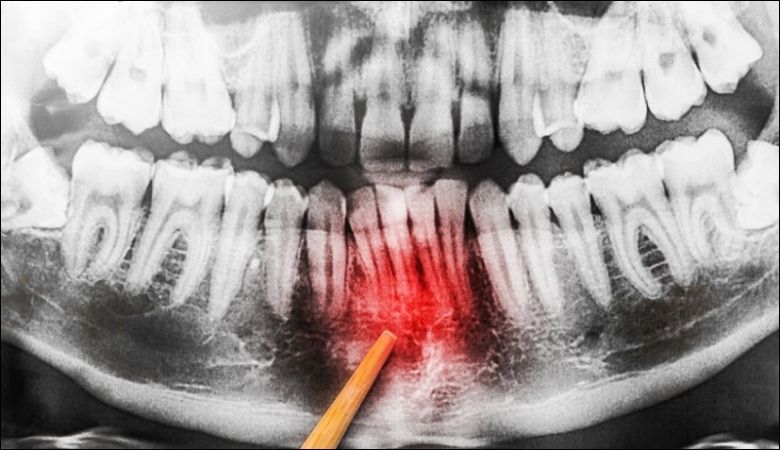duy trì vệ sinh răng miệng