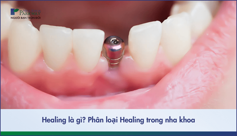 phân loại healing