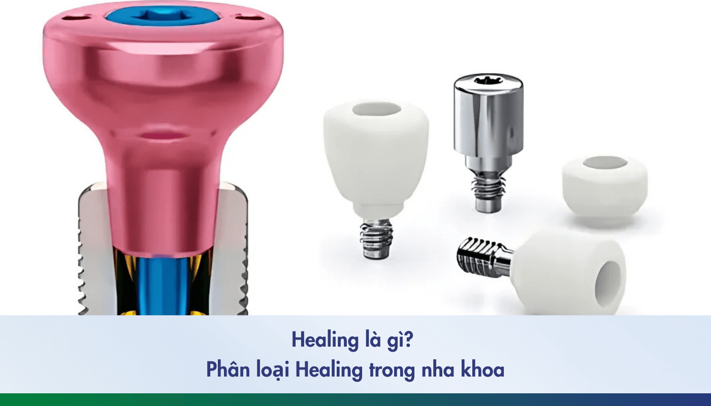 Healing trong nha khoa