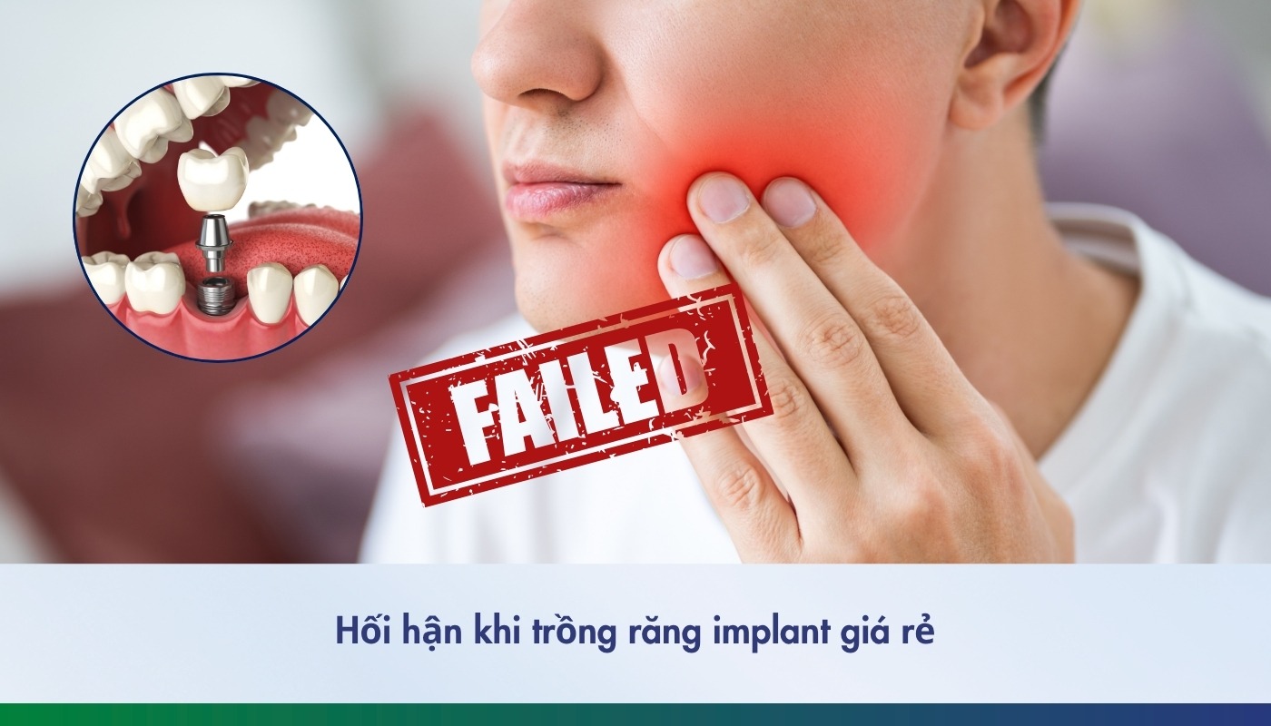 Hối hận khi trồng implant giá rẻ