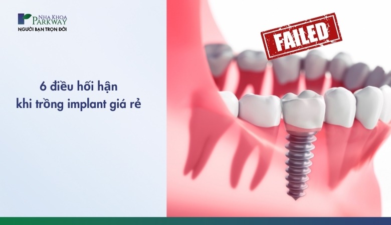 6 điều hối hận khi trồng implant giá rẻ