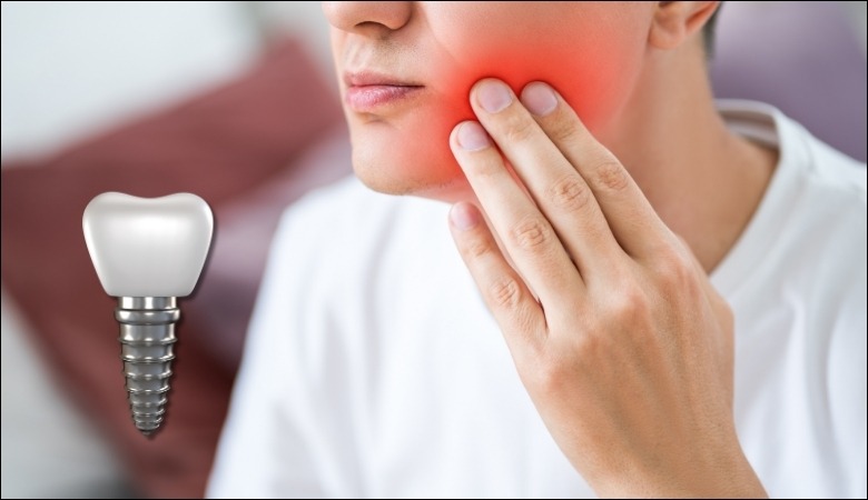 Bệnh nhân hối hận khi trồng implant giá rẻ và gặp tình trạng kích ứng