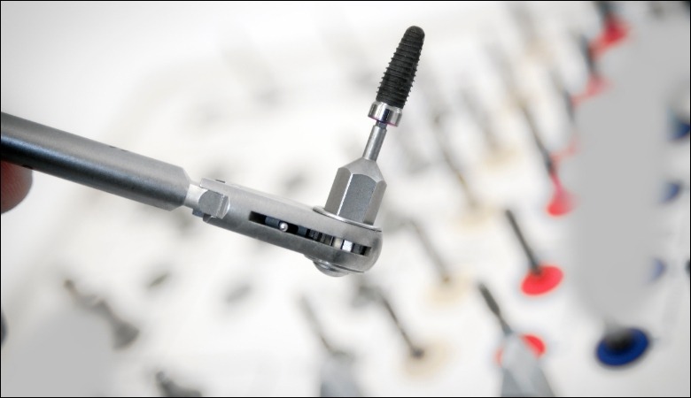 Lời khuyên khi chuẩn bị trồng răng implant