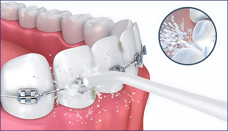 Lợi ích máy tăm nước