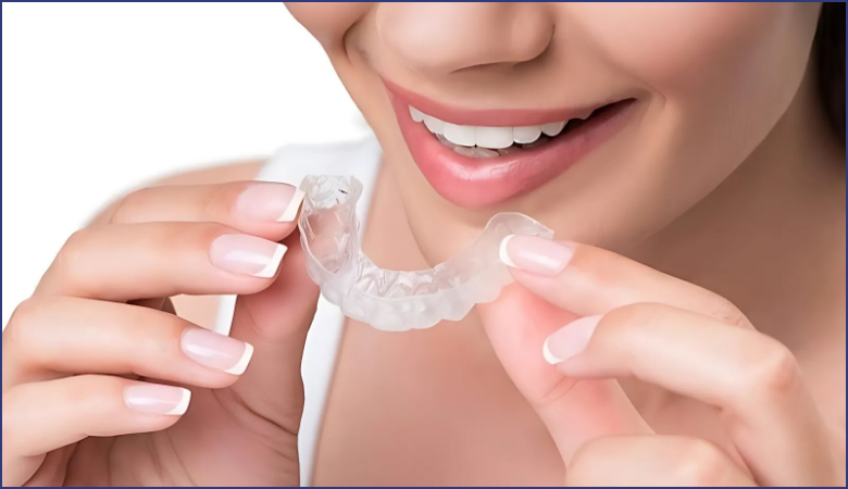 máng cống nghiến răng dạng nhiệt