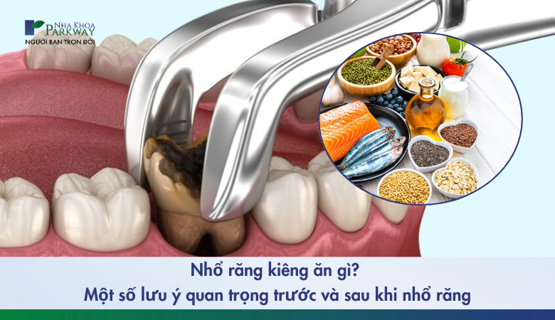 nhổ răng kiêng ăn gì