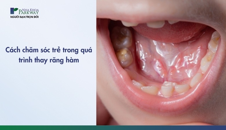 Chăm sóc trẻ đúng cách khi thay răng hàm