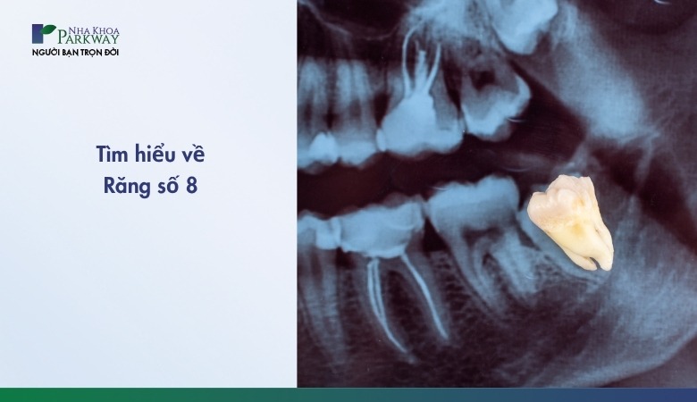 Răng số 8 là gì?