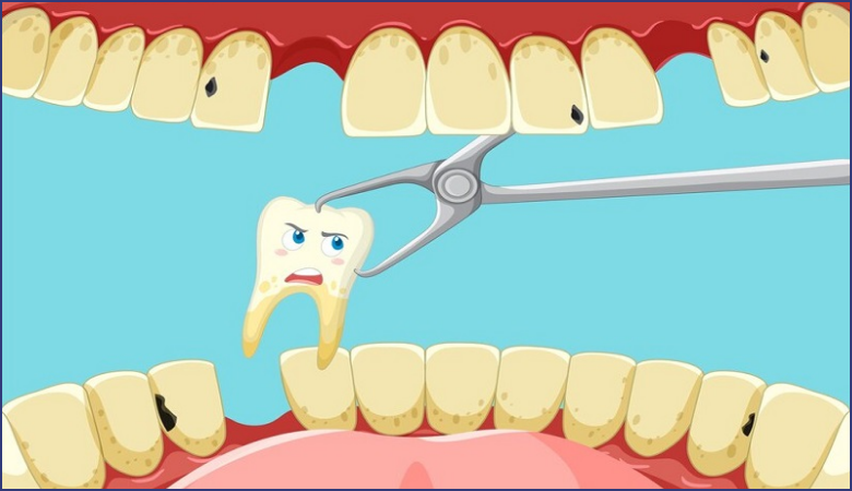 Vị trí và số lượng cần nhổ
