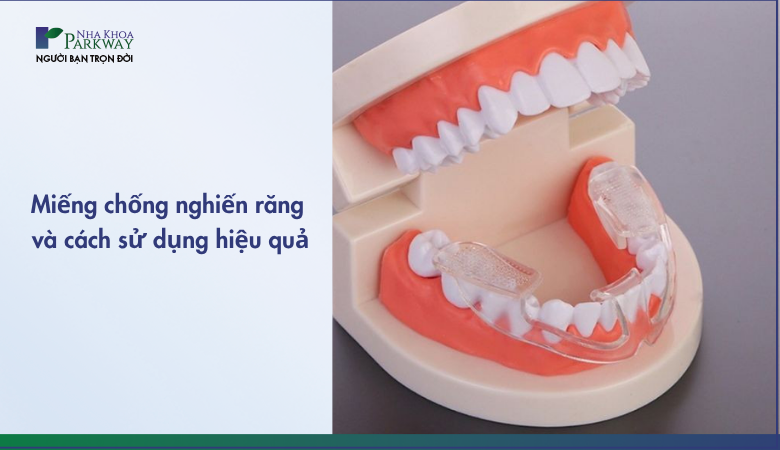 sử dụng máng chống nghiến răng hiệu quả