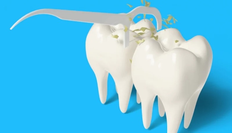 Phân loại tăm chỉ nha khoa