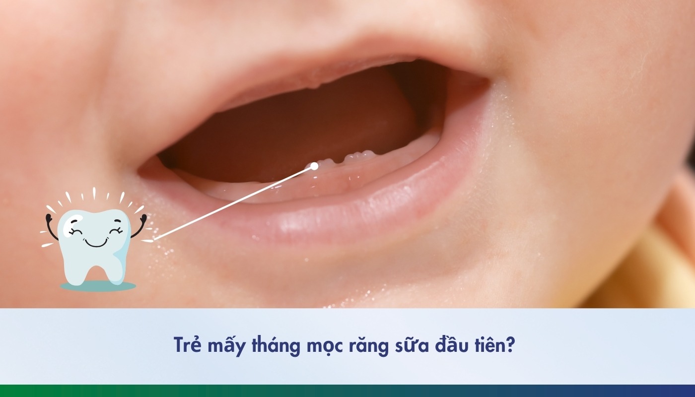 Trẻ mấy tháng mọc răng sữa đầu tiên