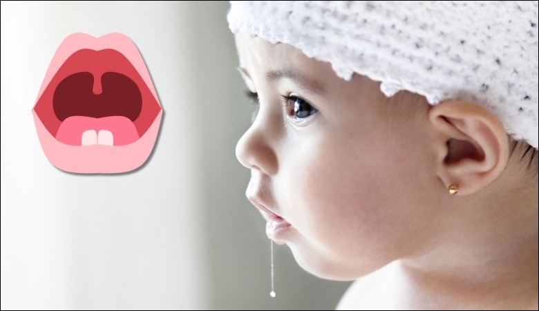 Trẻ chảy nước dải nhiều là dấu hiệu cho thấy đang mọc răng