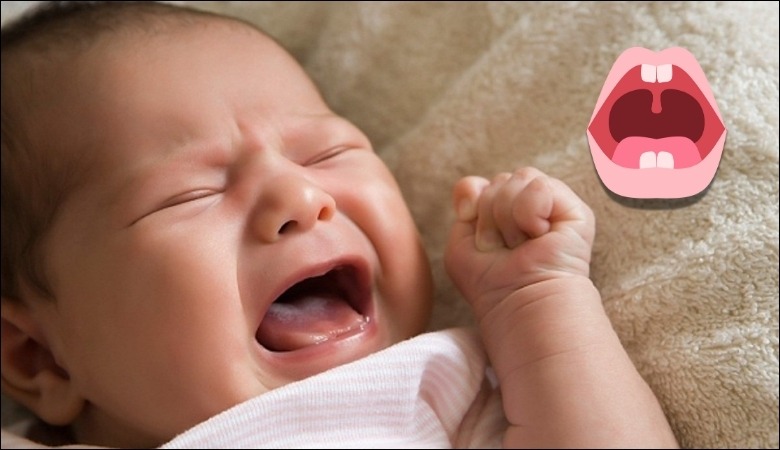 Trẻ mọc răng có thể quấy khóc và khó ngủ