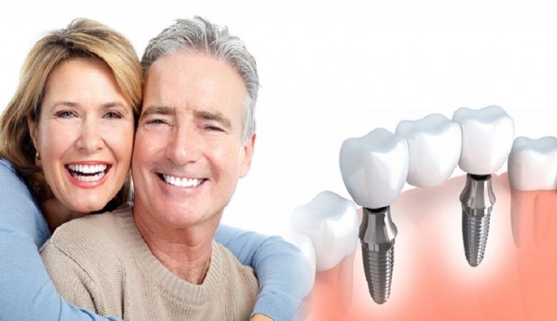 cần thời gian để xương hàm tích hợp với trụ implant, thường từ 3-6 tháng